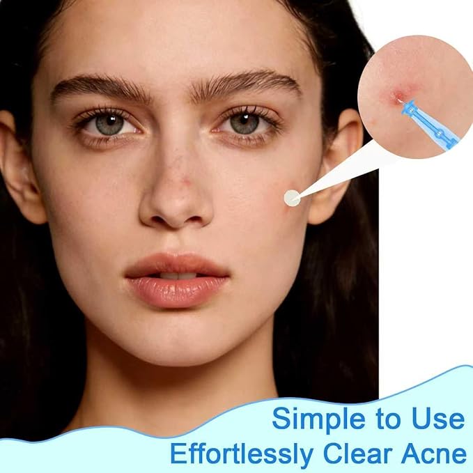 Sterile Needles for Pimples,50pcs Disposable Blackhead and Blemish Remover Tools and 72 Dots Pimple Stickers, for Acne, Whitehead, Comedone