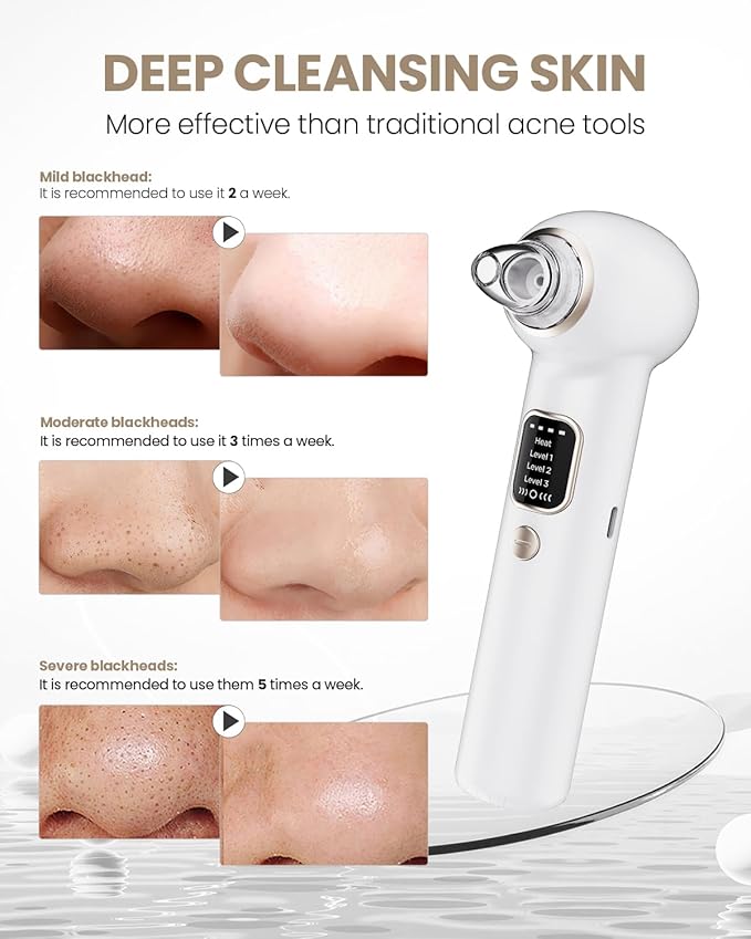 Electric Blackhead Remover Vacuum with Heating, 3 Suction Levels 5 Probes Pore Extractor Kit, Rechargeable Deep Pore Cleansing Tool for Women & Men (White)