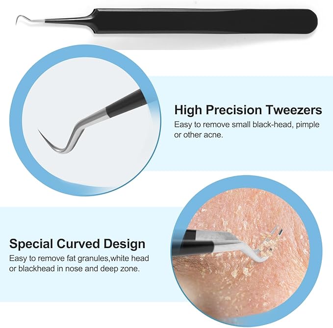 Blackhead Remover Tools Pimple Popper Tool Kit, Comedones Extractor Acne Removal Kit for Blemish, Black Head Remover for face Risk Free Treatment for Whitehead Popping