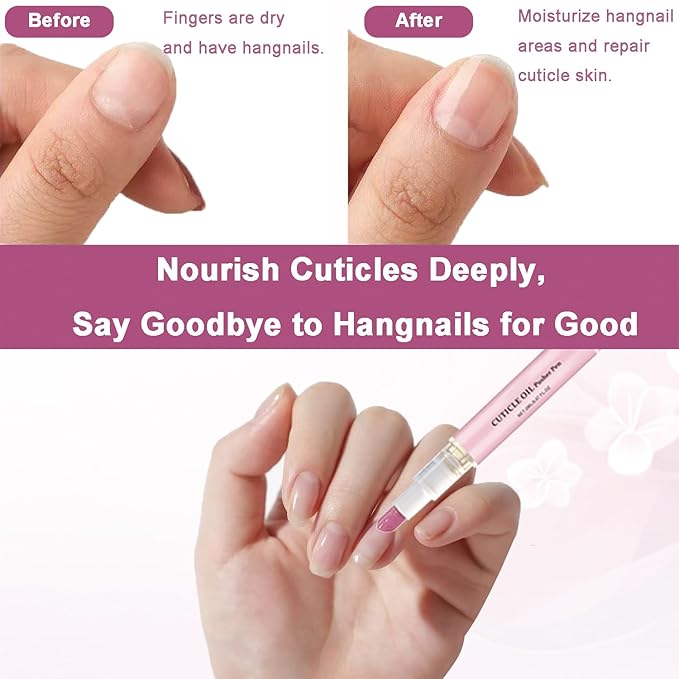 Ceramic Cuticle Pusher & Oil Pen, 1PC Gentle Cuticle Remover for Hangnails & Dry & Damaged Nails, Nail Care Pen for Repair & Nourish Nails