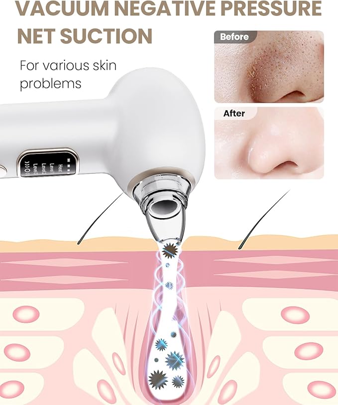 Electric Blackhead Remover Vacuum with Heating, 3 Suction Levels 5 Probes Pore Extractor Kit, Rechargeable Deep Pore Cleansing Tool for Women & Men (White)