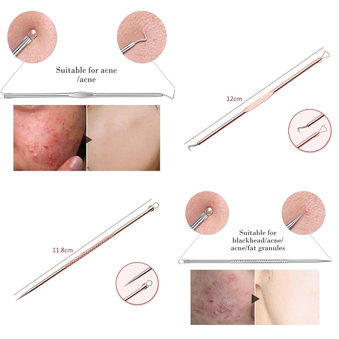 Blackhead Remover Pimple Comedone Extractor Tool Best Acne Removal Kit - Treatment for Blemish, Whitehead Popping, Zit Removing for Risk Free Nose Face Skin with Case(Rose, 4 Piece Set)