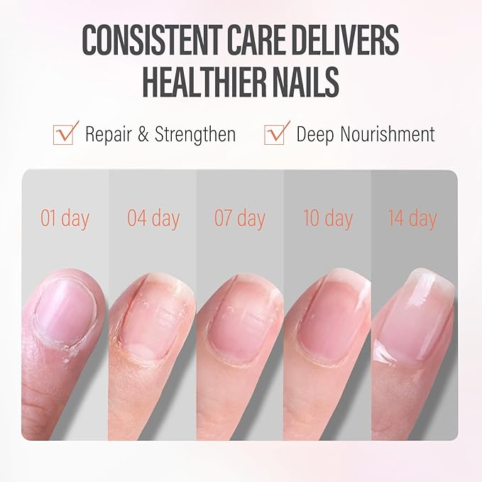 CHUCHU Nail Growth and Strengthener Oil for Cuticle - Peach Scent Cuticle Oil Repair Moisturizing Treatment - Natural Jojoba Vitamin B & E Nail Oil for Dry Cracked Nails