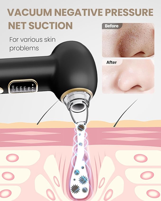 Electric Blackhead Remover Vacuum with Heating, 3 Suction Levels 5 Probes Pore Extractor Kit, Rechargeable Deep Pore Cleansing Tool for Women & Men (Black)