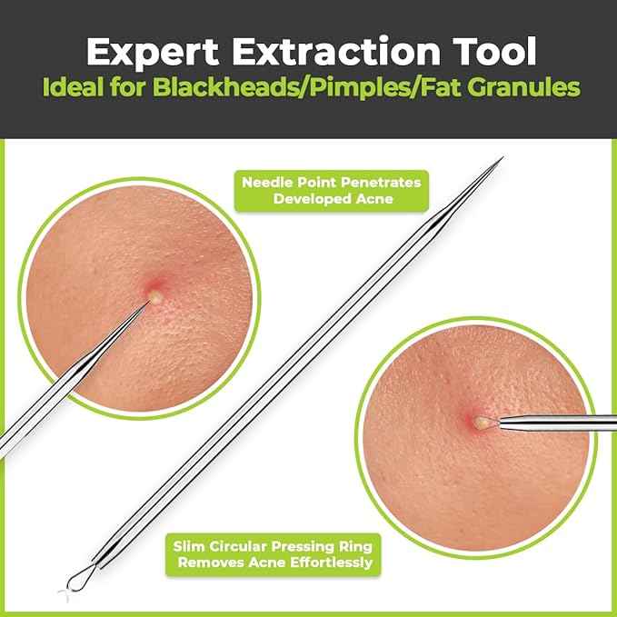 6 Pcs Blackhead Remover Tools 410 Grade Stainless Steel | Pimple Popper Tool Kit | Stainless Steel Professional Pimple Extractor Tool Kit for Blackheads, Comdone, Acne, Zit, and Whiteheads
