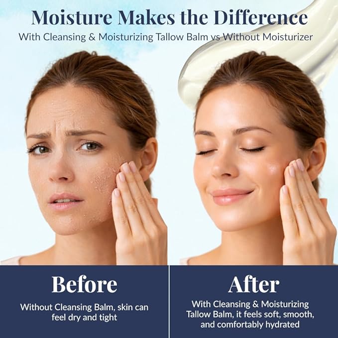 All-Natural Cleansing & Moisturizing Tallow Balm 9oz