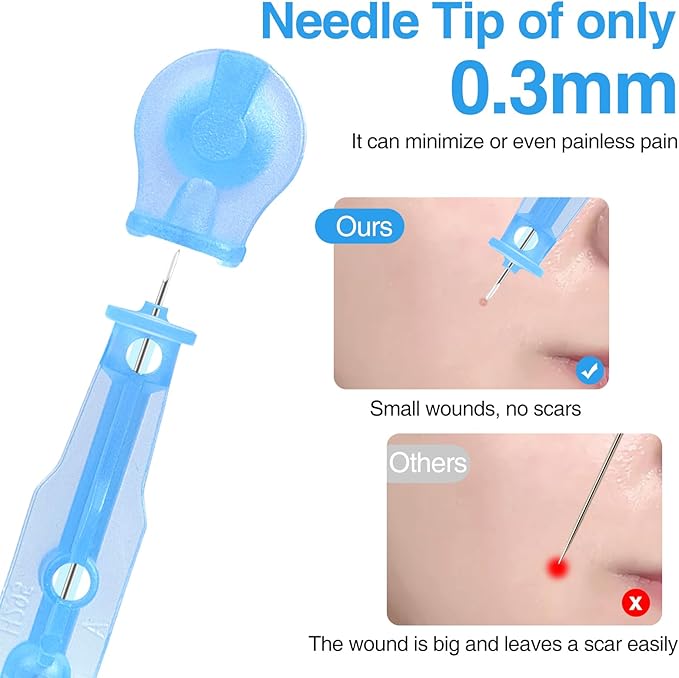 Sterile Pimple Needle Kit - 80 pcs 0.3mm Ultra-Fine Acne Needles + 108 Dots Acne Pimple Stickers - Effective Blemish & Blackhead Removal Tools for Clear Skin