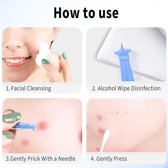 50 Pack Disposable Blackhead Remover Needles & Pimple Popper Tool Kit - Professional Acne Extractor Lancets for Whitehead, Comedone, Blemish Removal - Sterile Acne Needles with Case