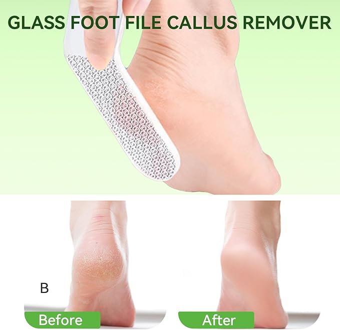 Glass Foot File Triangle Shaped Callus Remover Feet Heel Scrubber Dead Skin Scraper Pumice Stone Professional Pedicure Tools for Women and Men