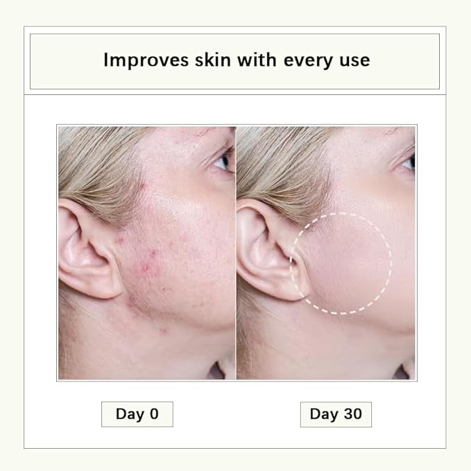 Natural Cleansing Oil – mini portable makeup remover oil, Nourishing and Gentle for Sensitive Skin and All Skin Types, Travel-Friendly, 2ml x 20 Capsules