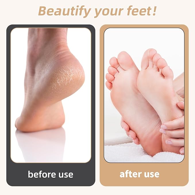 Foot Callus Remover, Foot File Callus Remover for Feet, Double Sided Foot Scrubber with Soft Silicone Brush (Yellow)