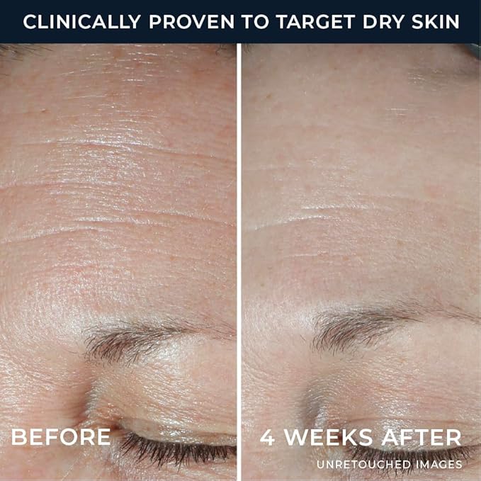 RoC Hydration+ Hyaluronic Acid Moisturizer Face Cream Fragrance Free Sensitive Face Moisturizer with Collagen Proteins 1.7 Ounces with Retinol Eye Cream Packette