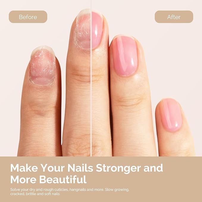 MelodySusie 2Pcs Cuticle Oil,Nail Strengthener with Jojoba & Vitamin E, Nail Growth that Repairs Cuticles & Promotes, Moisturizes & Conditions Dry Skin,15ml Rose and Lavender