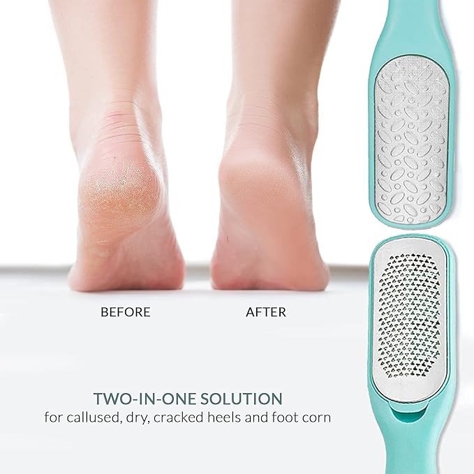 Callus & Dead Skin Remover – Dual-Sided - for Wet & Dry Exfoliation: Scrub, File & Rasp for Smooth Feet - Pedicure Tool - Foot File Callus Remover Tool - Pedicure Kit