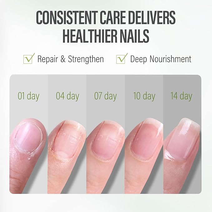 CHUCHU Nail Cuticle Oil Strengthener - Aloe Vera Scent Repair Growth Moisturizing Treatment - Natural Jojoba Vitamin B & E for Dry Cracked Nails