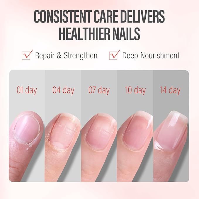 CHUCHU Nail Growth and Strengthener Oil for Cuticle - Pomegranate Scent Cuticle Oil Repair Moisturizing Treatment - Natural Jojoba Vitamin B & E Nail Oil for Dry Cracked Nails