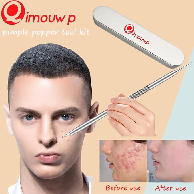 Pimple Popper Tool Kit, 16 Pcs Blackhead Remover Tools, Professional Tweezers Set Comedone Extractor Acne Tool for Zit Blemish Whitehead Cyst Eyebrows Removal, Beauty Tools for Face