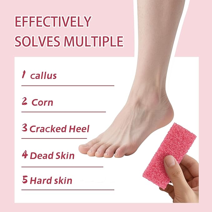 NOVAL Pumice Stone for Feet Scrubber Dead Skin Disposable Foot Pumice Foot Callus Remover Pedicure Tools Pink Pumice Sponge Nail Salon Home Use,40 PCS