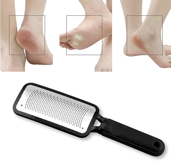 Professional Foot Files Callus Remover,Foot Scrubber for Dead Skin,Stainless Steel Foot Rasp-Black（1 Pack）