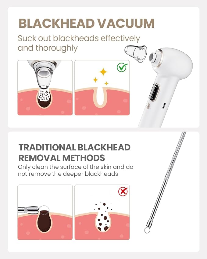 Electric Blackhead Remover Vacuum with Heating, 3 Suction Levels 5 Probes Pore Extractor Kit, Rechargeable Deep Pore Cleansing Tool for Women & Men (White)