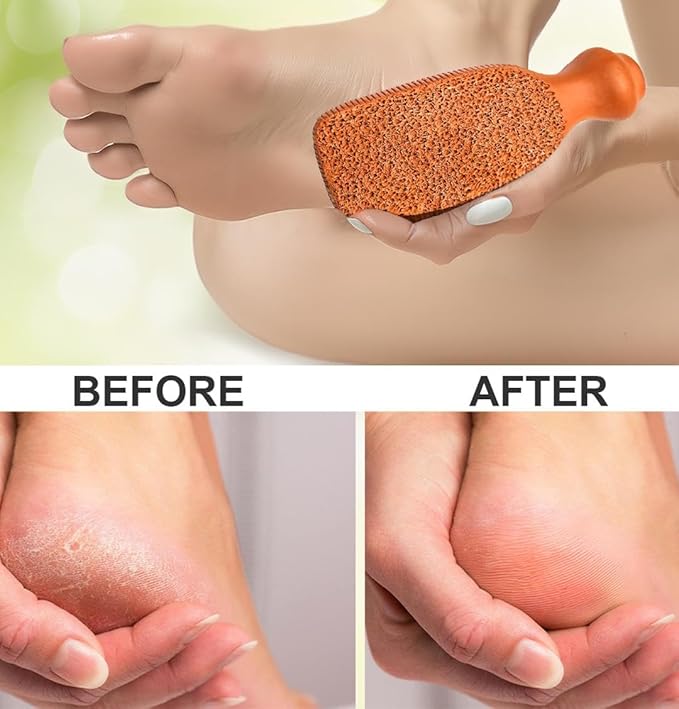Pumice Stone for Feet - 2-Sided Terra Cotta Foot Scrubber, Professional Exfoliating Clay Stone for Feet Hands Body Care - Pumice Stone for Feet Callus Remover, Brown