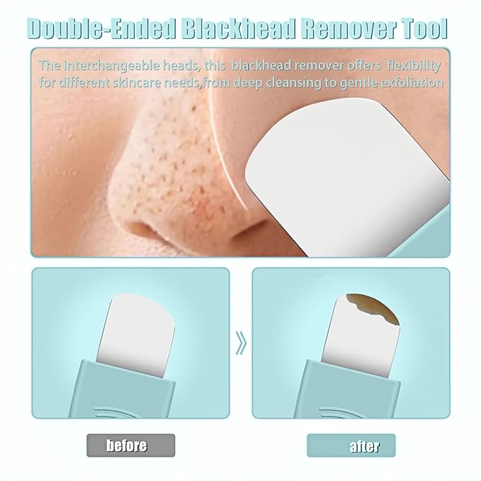 Blackhead Remover & Pimple Extractor Kit Dual-Ended Skin-Friendly Design for Sensitive Skin Professional Pore Cleanse & Acne Home Facial Care Tools with Stainless Steel Scraper (Blue-with Needle)