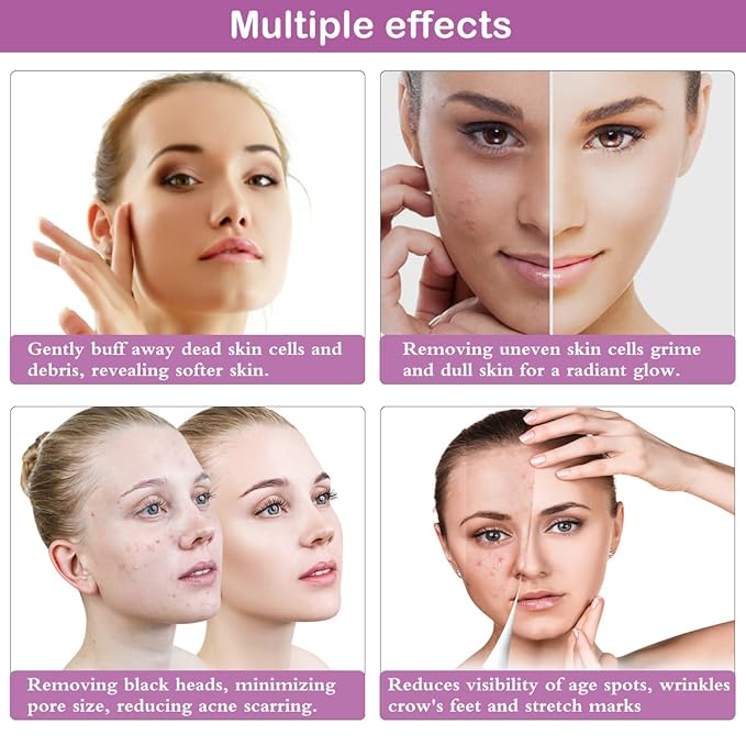 Diamond Microdermabrasion Machine, Yofuly 65-68cmHg Suction Power Professional Dermabrasion, Home Use Facial Skin Care Equipment