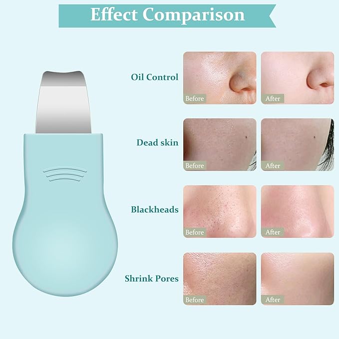 Blackhead Remover Tool,Silicone Face Scrubber, 2 in 1 Nose Pore Scraper for Deep Cleansing,Face Skin Spatula, Nose Black Head Remover, Pore Cleaner Skin Care Tool for Men Women Gifts