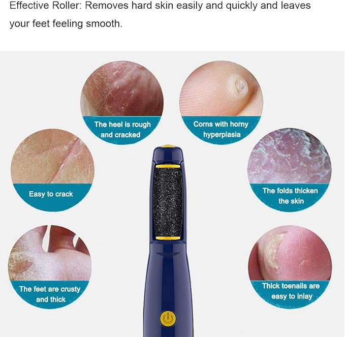 Replacement Roller Compatible with Dr. Scholl's Callus Remover Electronic Foot File-Extra Coarse (6 Pack)
