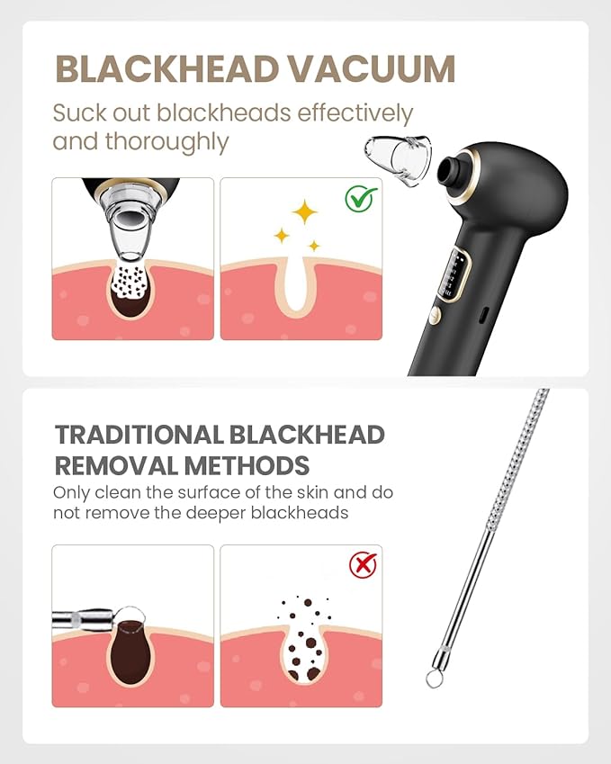 Electric Blackhead Remover Vacuum with Heating, 3 Suction Levels 5 Probes Pore Extractor Kit, Rechargeable Deep Pore Cleansing Tool for Women & Men (Black)