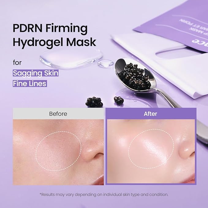 BIODANCE Rejuvenating Caviar PDRN Real Deep Mask, Overnight Hydrogel Face Mask, Skin Firming, Radiance, Enhancing Skin Recovery, Korean Skin Care | 1.19oz(34g) x 4ea