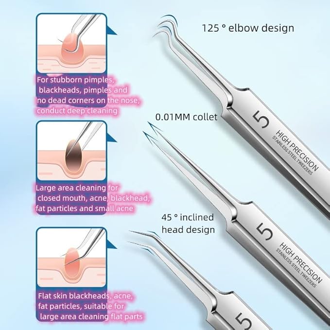 Professional Facial Blackhead Remover Tweezers,Extractor Acne Removal Kit Pimple Popper Tool, Clip for Whiteheads, Acne Clip, Ingrown Hairs Tweezers, Blackheads Remover Extractor, Stainless Steel