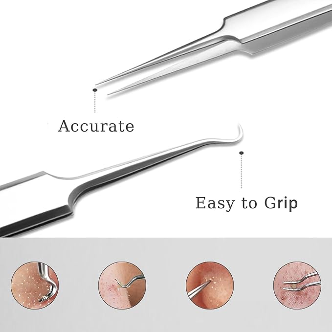 5pcs Blackhead Remover Tweezers Pimple Popper Tool Kit, Precision Acne Needle Comedone Blackhead Tweezers Extractor Removal Whitehead Popping Zit for Nose Face Skin Blemish Extractor Tool