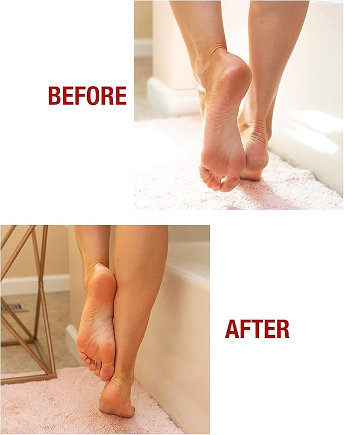 Kerasal Intensive Foot Repair Skin Healing Ointment,1 Oz and Moisturizing Gel Socks,(Packaging May Vary),(Pack of 4)