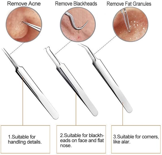 Blackhead Remover Kit - FEITA Blackhead Tweezers Removal Tool Kit Set - Acne Tweezers Pimple Comedone Extractor with Travel Case (5 Pcs)