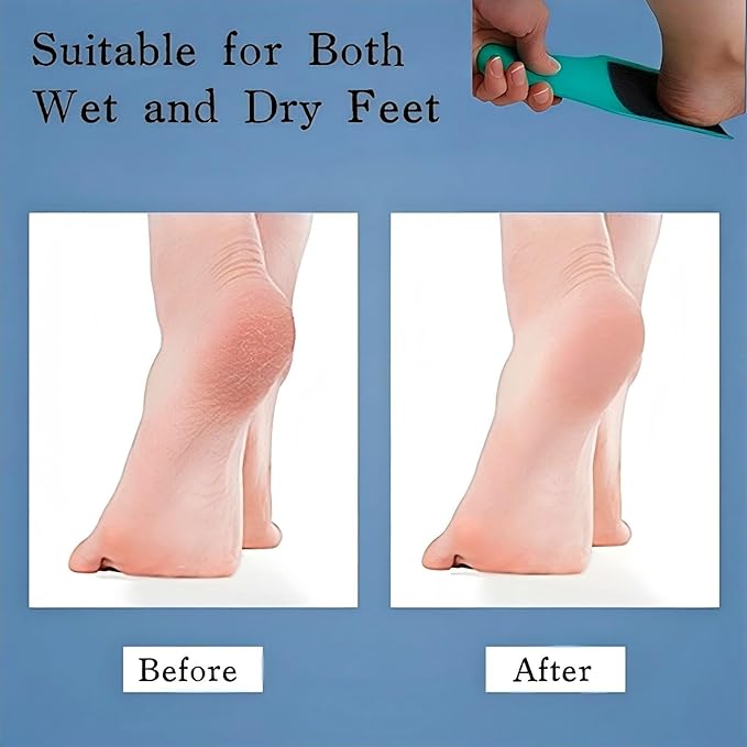 U-Shaped Curved Foot File, Double-Sided Dead Skin Callus Remover, Foot Scrubber for Wet and Dry Feet – Curved Design for Full Heel & Side Exfoliation‌, 1 PCS Light Green