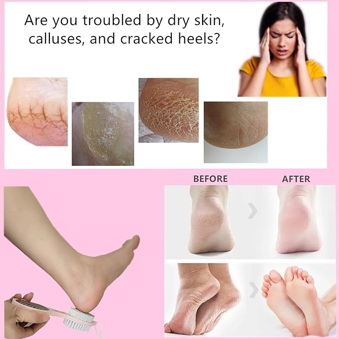 Foot File Callus Remover 5-in-1, 2 Pcs Feet Scraper Pedicure Tools with Pumice Stone, Scrubber Brush, Stainless Steel Foot Rasp and Sand Paper Debris Catcher, Multi Purpose, Pink