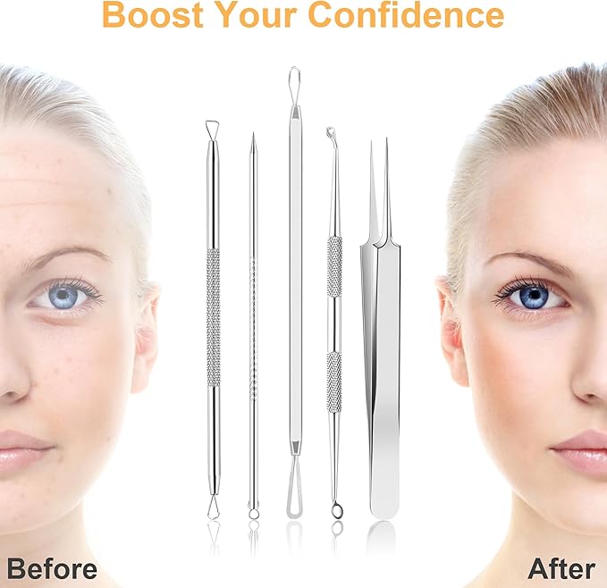 Blackhead Remover Tools, 9PCS Pimple Popper Tool Kit - Stainless Steel Pimple/Comedone Extractor & Tweezers for Acne/Zit Removal, Nose & Face Extraction Tools for Estheticians with Leather Case