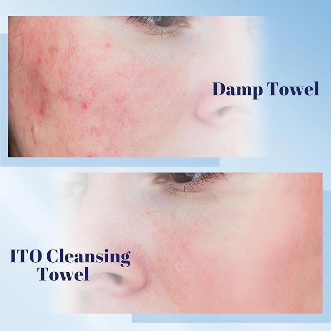 ITO Disposable Face Towel, Ultra-Soft 1-Second Quick-Dry Face Towels, Gentle for Sensitive Dry Oily Skin, Facial Towels for Daily Cleansing Makeup Removal (180 Count (Pack of 3))
