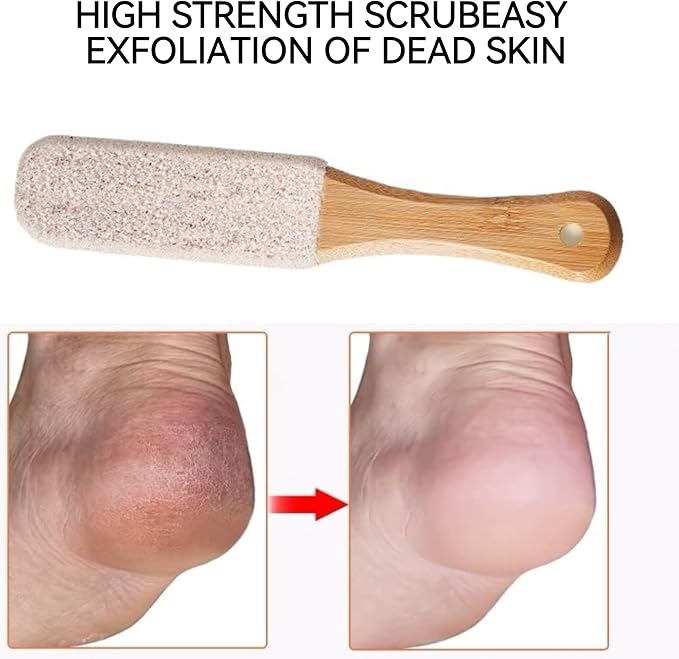 2-Pack Professional Pedicure Foot File & Pumice Stone - Callus Remover and Foot Scrubber for Dead Skin, Dry Rough Feet and Cracked Heels