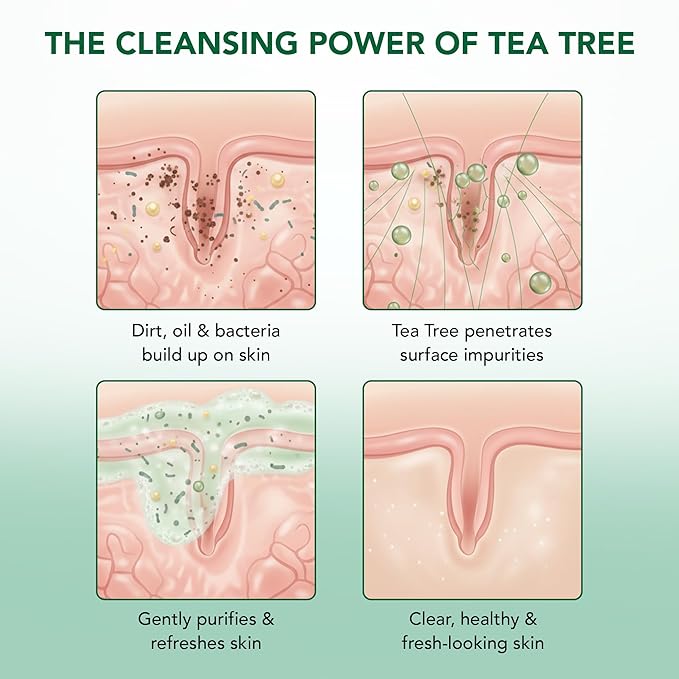 Botanic Hearth Tea Tree Body Wash -16 fl oz- All-Natural Antifungal & Odor-Control Shower Gel for Acne, Athlete’s Foot, Ringworm, Jock Itch & Healthy Skin,Sulfate & Paraben Free, for Men and Women