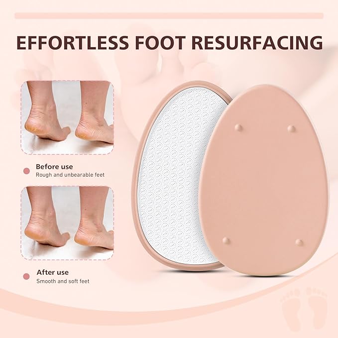 BALUCA Glass Foot File Callus Remover for Feet - Nano Glass Foot Scraper Scrubber Dead Skin Removal for Cracked Heels,Professional Pedicure Tool for Home, Salon, and Travel (Apricot)