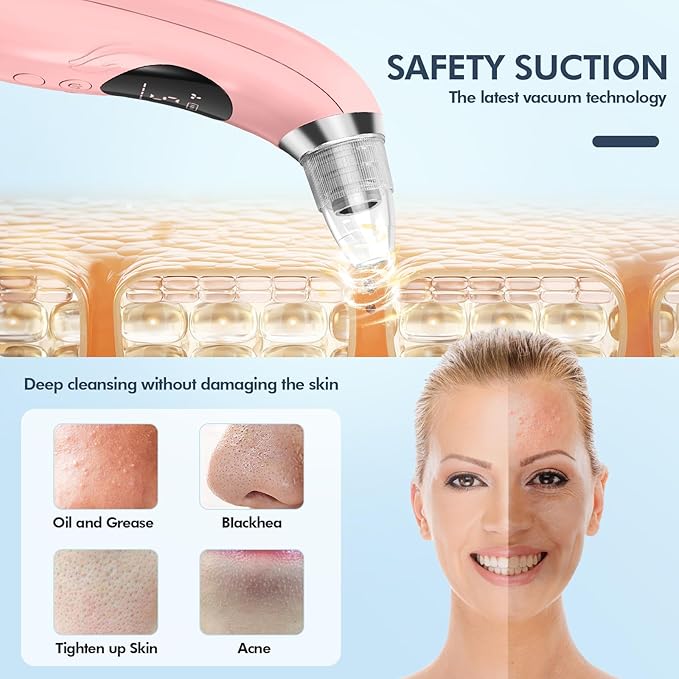 Blackhead Remover Pore Vacuum with Camera - Upgraded Black Head Remover for Face, Electric Acne Comedone Whitehead Extractor Tools - 5 Modes, 3 Probes, Pimple Popper Tool Ki