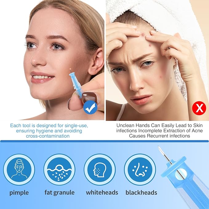 Sterile Pimple Needle Kit - 80 pcs 0.3mm Ultra-Fine Acne Needles + 108 Dots Acne Pimple Stickers - Effective Blemish & Blackhead Removal Tools for Clear Skin