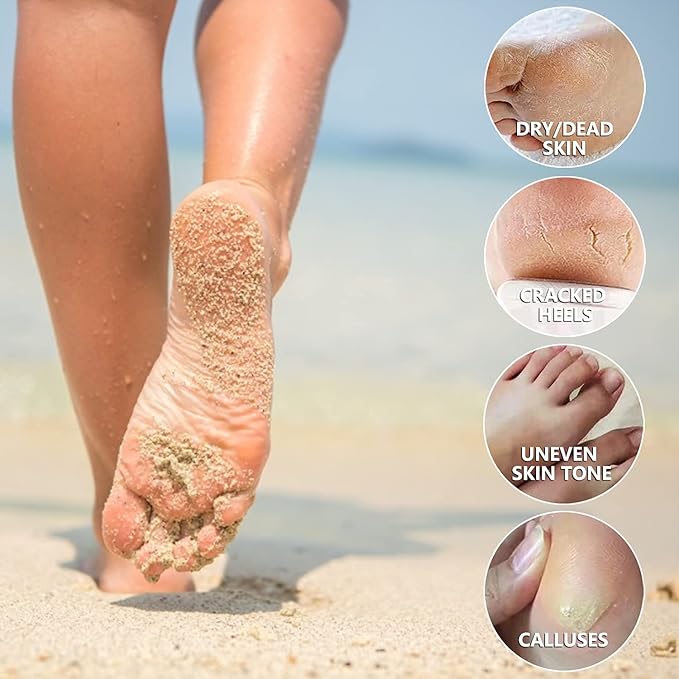 5 Pack Foot Peeling Mask,Exfoliator Peel Off Calluses Dead Skin Callus Remover,Foot Mask for Dry Cracked Feet,Foot Peel Masks for Men and Women Feet Peeling Mask for Easter Basket Stuffers Gifts