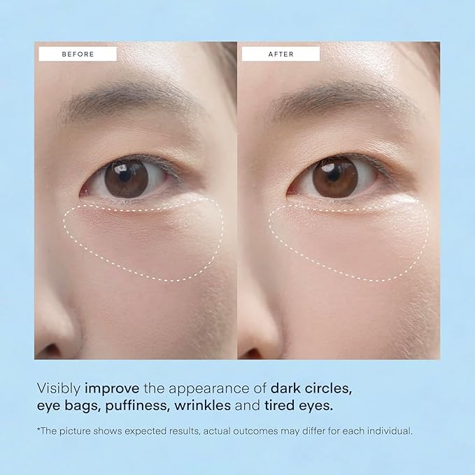 Terez & Honor Under Eye Patches for Dark Circles - 60 Korean Hydrogel Masks for Puffiness, Bags, Wrinkle with Caffeine, Hyaluronic Acid, Niacinamide - Undereye Hydrating & Cooling, Vegan, No Fragrance