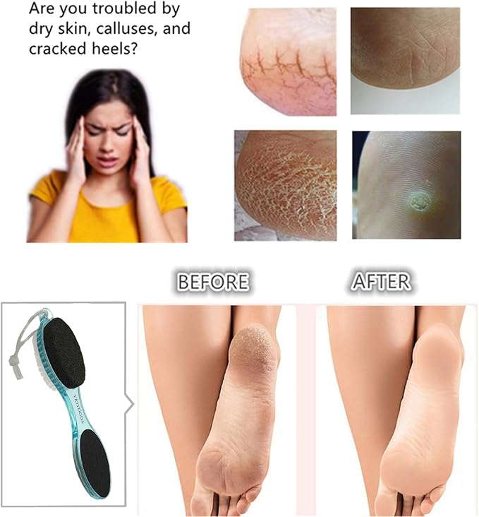 Foot File Callus Remover 4-in-1, 3 Pcs Feet Scraper Pedicure Tools with Pumice Stone, Scrubber Brush, Foot Rasp and Sand Paper, Double Sided Multi Purpose, Clear Pink, Blue, Black