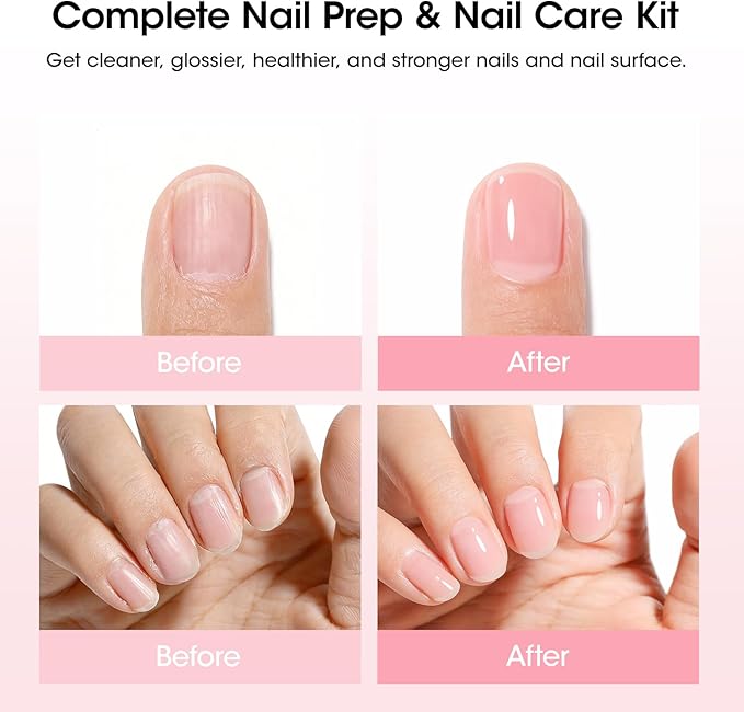 Gellen Nail Care Kit Manicure Tools Kit: Nail Strengthener and 2Pcs Nail File & Buffer 100/180, Cuticle Pusher Pen, Cuticle Oil & Remover, Fork | Nail Clipper & Brush