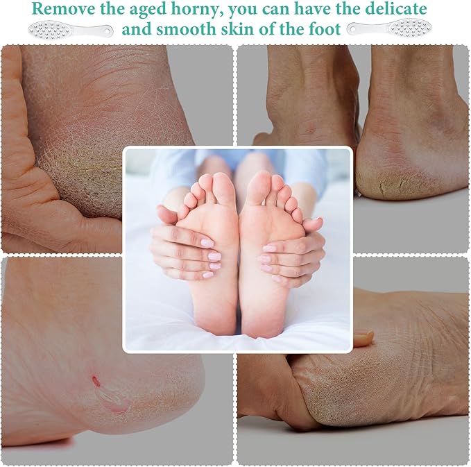 2 Pcs Stainless Steel Foot Scraper Metal Foot File Double Sided File Callus Remover Professional Feet Rasp Scrubber for Wet or Dry Skin Easy to Clean Pedicure Tool Heel (Fresh Style)
