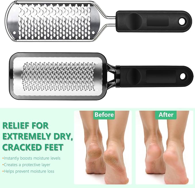 Professional Pedicure File and Callus Remover - Stainless Steel Material, Ergonomic Handle, can Easily Remove Hard Skin, Callus, Dryness, Leaving Your feet Soft and Smooth (Home/Salon use)